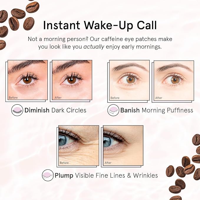 grace & stella Caffeine Under Eye Patches - Awakening Eye Patches for Puffy Eyes and Dark Circles - Under Eye Mask Patches with Niacinamide & Hyaluronic Acid - Vegan, Cruelty-Free (Bronze, 24 Pairs)