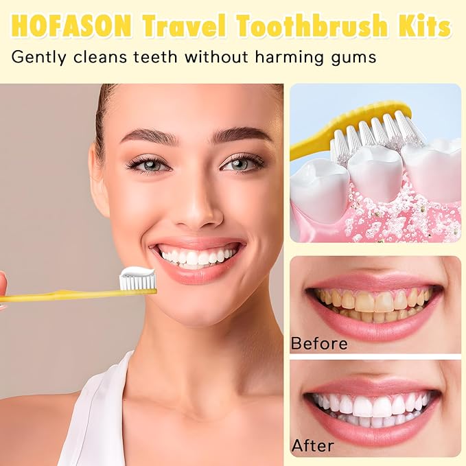 HOFASON Disposable Toothbrushes with Toothpaste Pack of 300, Yellow Hollow Travel Toothbrush Set with 5g Toothpaste Individually Wrapped Toothpaste Bulk for Homeless, Nursing Home, Shelter, Hotel